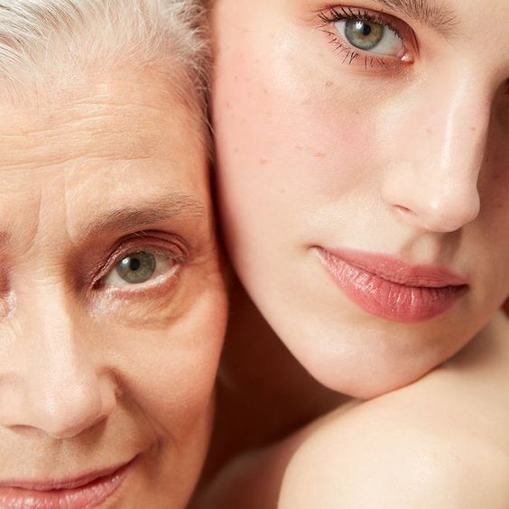 Raukšlės ir senėjimas